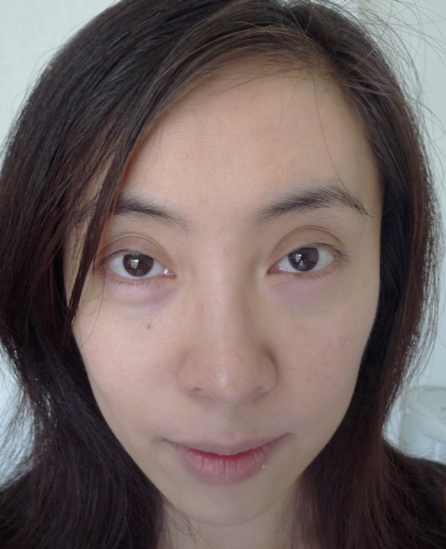 【一夜就變白】我去做日式光纖美白雷射了啦!(有圖有真相啊!)