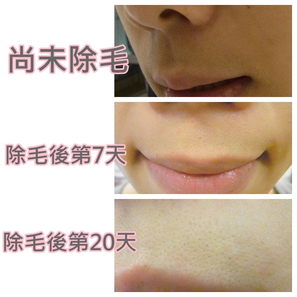 ~~<em>女生长胡子</em>最佳清除方法~~ - 鱼妞美妆天地