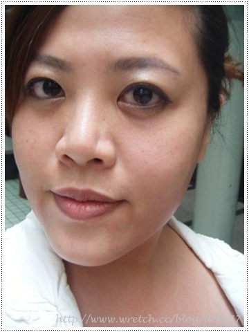 【医学美容】我的络腮胡要曝光了之小脸电波初