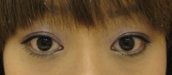 春天到~來個紫色迷濛大眼吧!
