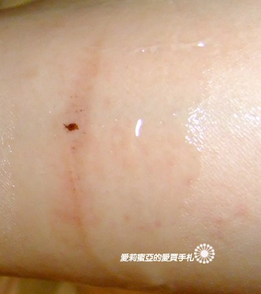 2010_10雷射後的護膚紀錄