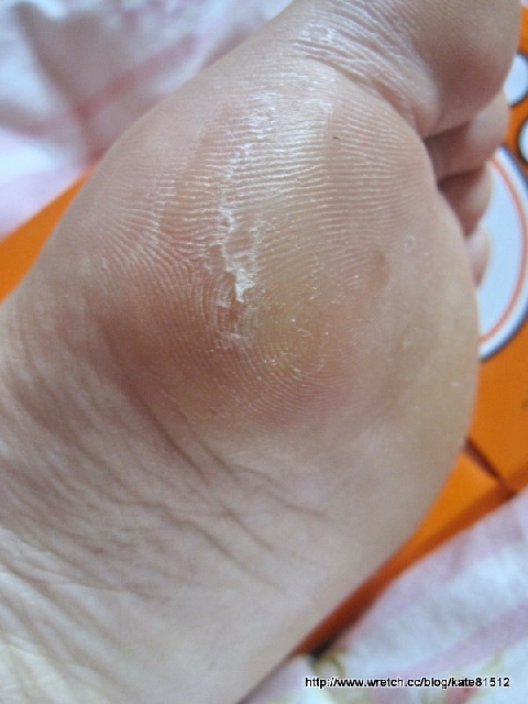 夏天到了小嫩腳準備好了沒???足�美人還妳嫩嫩腳