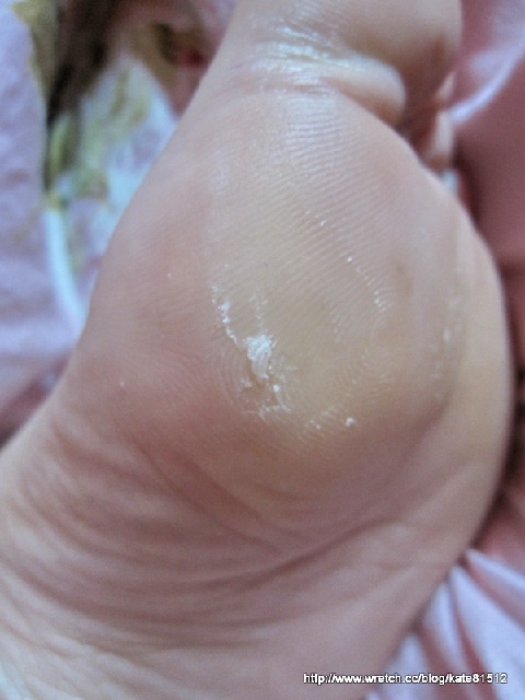 夏天到了小嫩腳準備好了沒???足�美人還妳嫩嫩腳