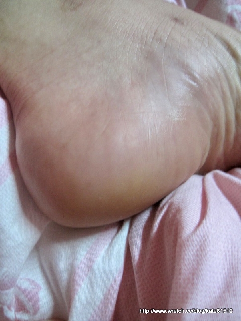 夏天到了小嫩腳準備好了沒???足�美人還妳嫩嫩腳