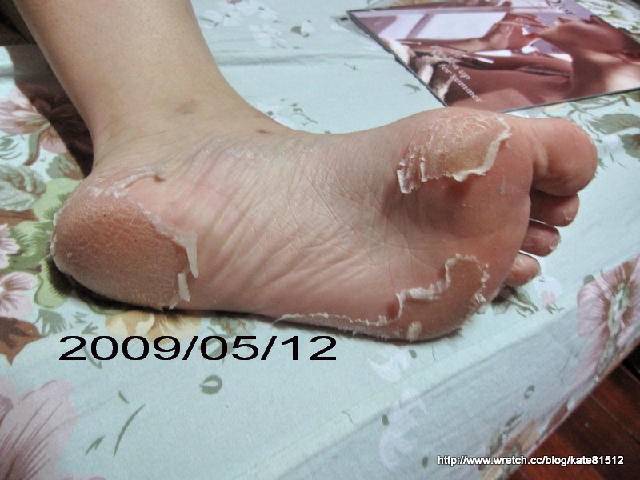 夏天到了小嫩腳準備好了沒???足�美人還妳嫩嫩腳