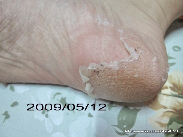 夏天到了小嫩腳準備好了沒???足�美人還妳嫩嫩腳