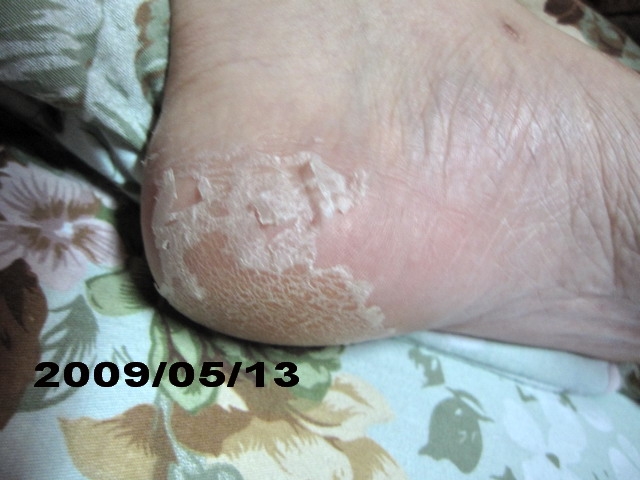 夏天到了小嫩腳準備好了沒???足�美人還妳嫩嫩腳