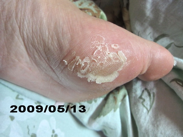 夏天到了小嫩腳準備好了沒???足�美人還妳嫩嫩腳