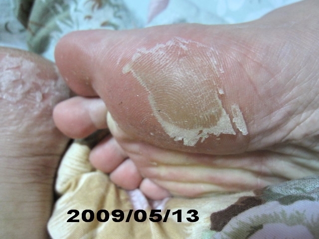 夏天到了小嫩腳準備好了沒???足�美人還妳嫩嫩腳