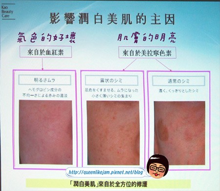 打擊霧狀斑點讓你白透亮~Sofina Whitening瀅白記者會