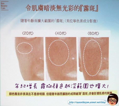 打擊霧狀斑點讓你白透亮~Sofina Whitening瀅白記者會