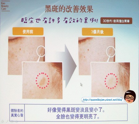 打擊霧狀斑點讓你白透亮~Sofina Whitening瀅白記者會