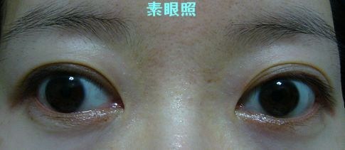超便宜又自然!晨欣魔術雙眼皮膠條+使用說明