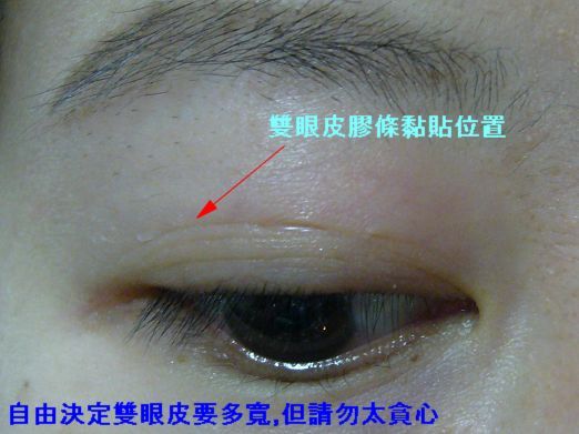 超便宜又自然!晨欣魔術雙眼皮膠條+使用說明