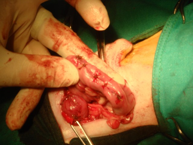 (内有money手术血腥照片!