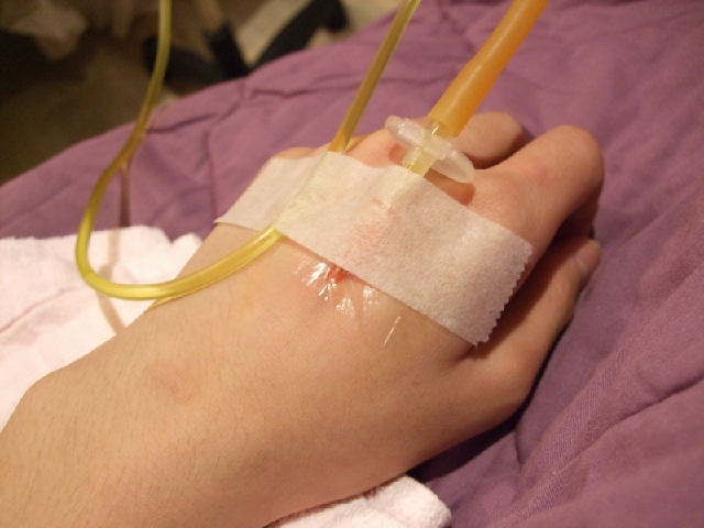 正妹の美白秘技!美白针!