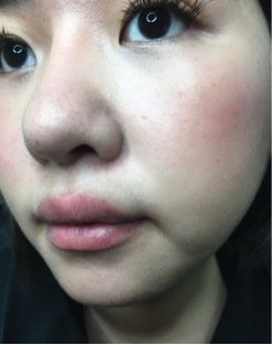 拯救干粉底~妆前用DF玻尿酸保湿补水面膜