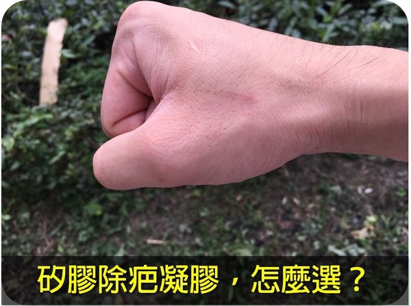 矽膠除疤凝膠,怎麼選?