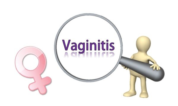 女性陰道炎保健觀念釐清