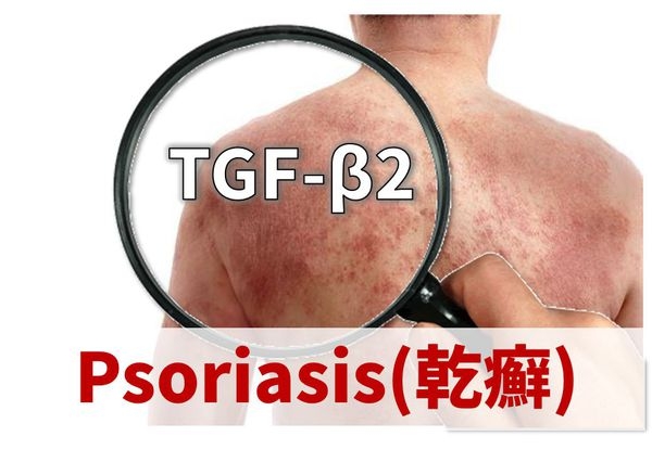 乾癬的營養治療新趨勢:牛乳清蛋白萃取物