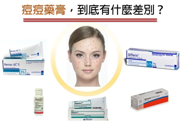 常見外用青春痘藥物快功,千萬別用錯喔!!!