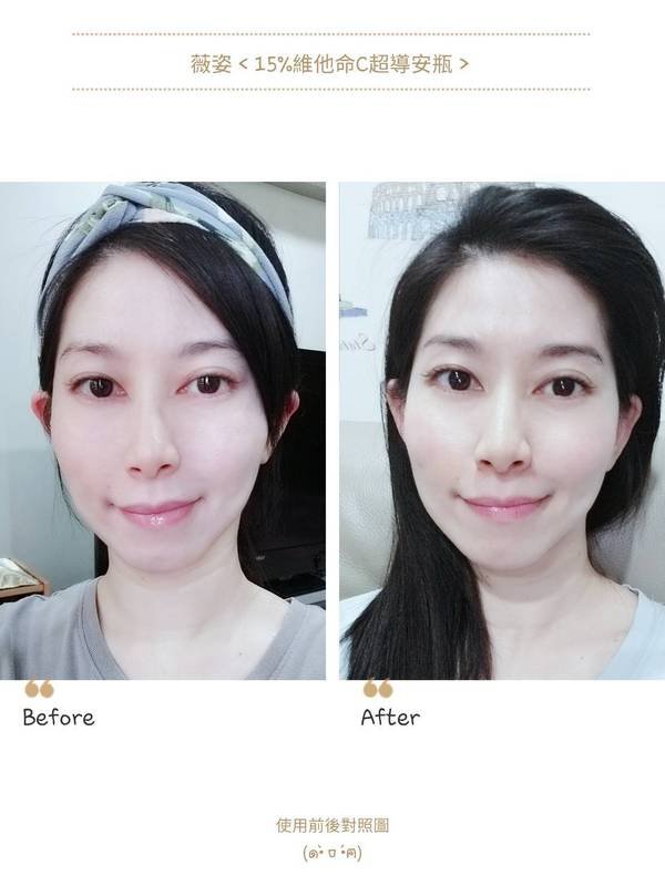 VICHY薇姿15%維他命C超導安瓶,安瓶推薦,維他命C,加強提亮
