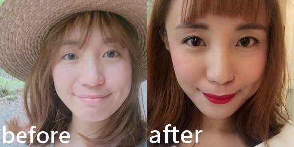 【醫美】全新【輕感水微晶】少了醫美注射痛又能搞定下巴!