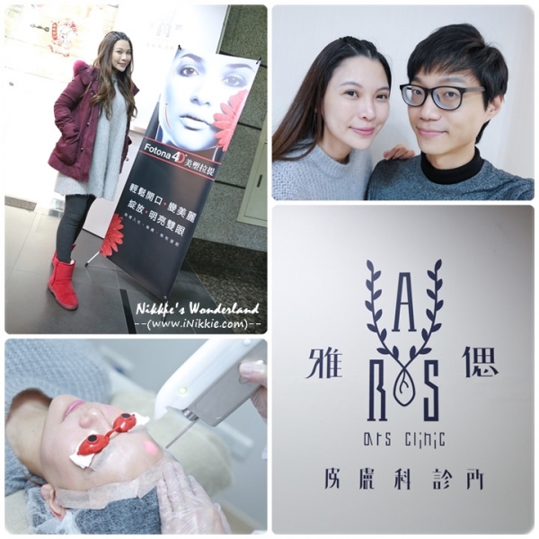 雅偲診所 FOTONA 4D 美塑光波拉提~ 快速無痛、即時有感的美顏術!