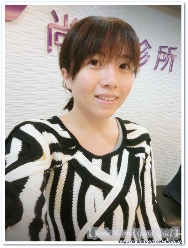 【醫美】臉蛋休息 | 淨膚雷射初體驗,本日尚安診所。