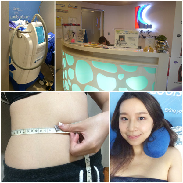酷塑冷凍減脂 coolsculpting - 躺著就瘦腰圍6公分!