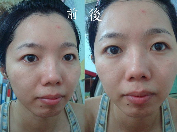 比较一下前后的肤色,印堂有比较亮一些些,其他还好.