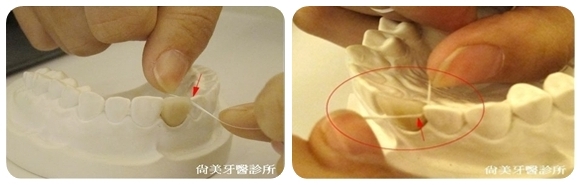 【邀稿】牙齦出血不要來,高露潔全效牙齦護理專家