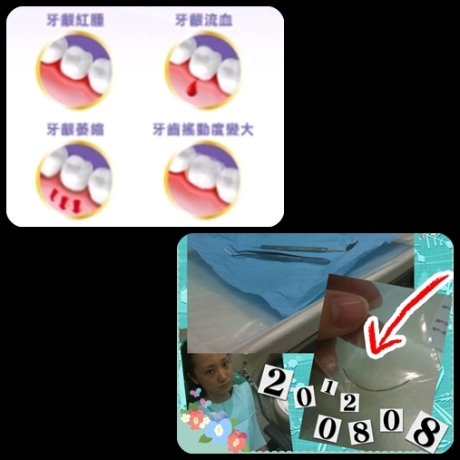 【邀稿】牙齦出血不要來,高露潔全效牙齦護理專家