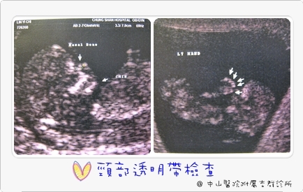I am pregnant‧‧‧我懷孕了!