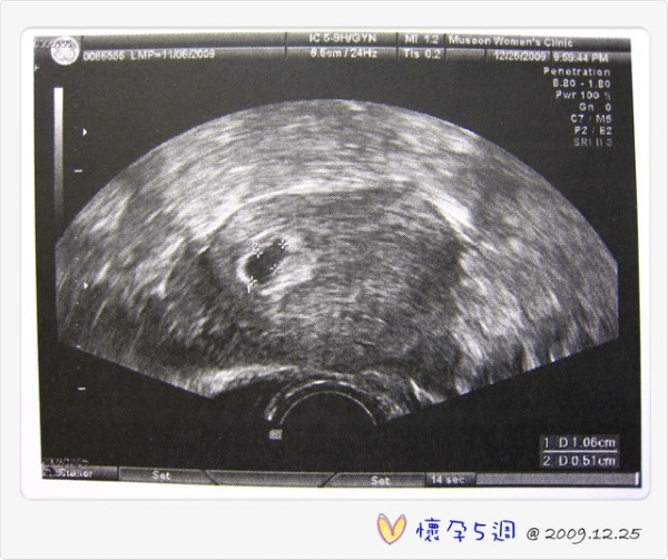 I am pregnant‧‧‧我懷孕了!