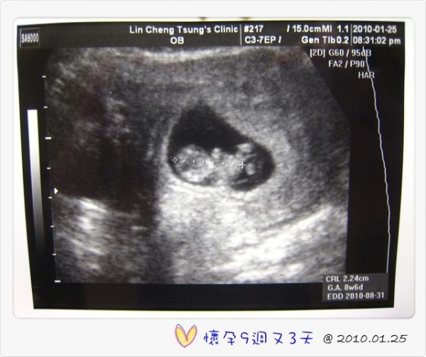 I am pregnant‧‧‧我懷孕了!