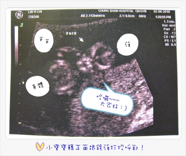 I am pregnant‧‧‧我懷孕了!