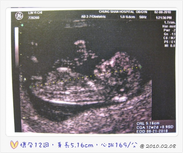 I am pregnant‧‧‧我懷孕了!