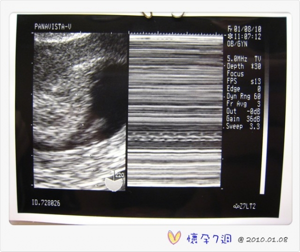 I am pregnant‧‧‧我懷孕了!
