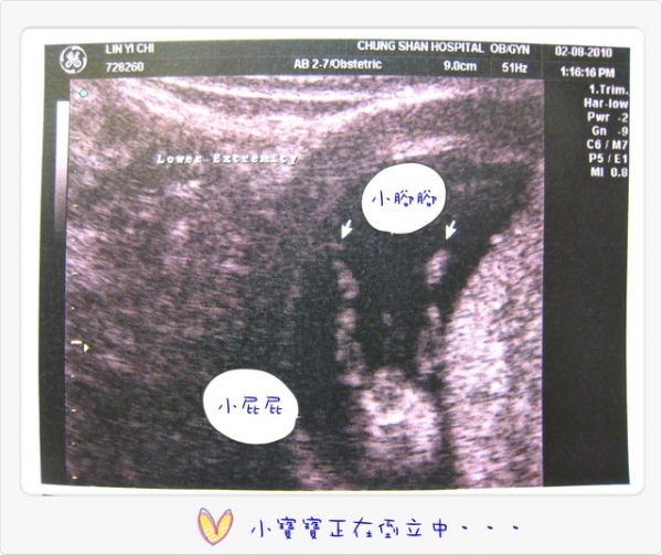 I am pregnant‧‧‧我懷孕了!