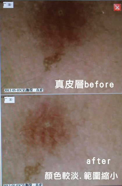 【體驗】寵愛媽咪。NB自然美全新形象概念店
