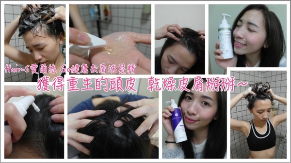 白雪飄飄掰掰*Hair-S愛爾絲 Go健康去屑洗髮精/Go調理頭皮理療精華液,乾性頭皮的皮屑消失了?!真好~