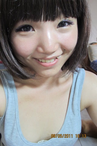 牙套日記♥Day.1 ( 2011.8.23 )