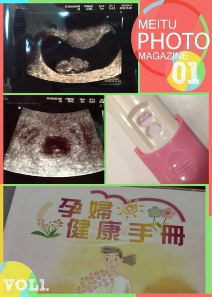 【懷第四胎】歡迎我們家的第四寶光臨!